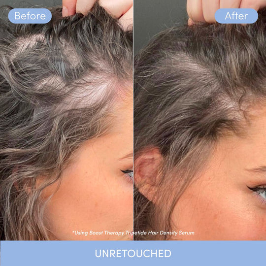 Tripeptide Hair Density Serum - alternate view